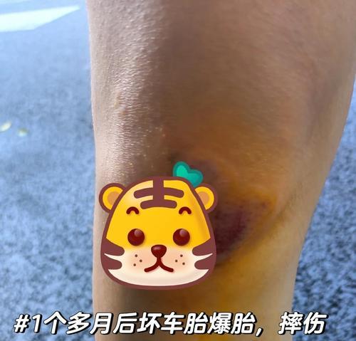 电瓶车轮胎扎钉子后如何应急处理？