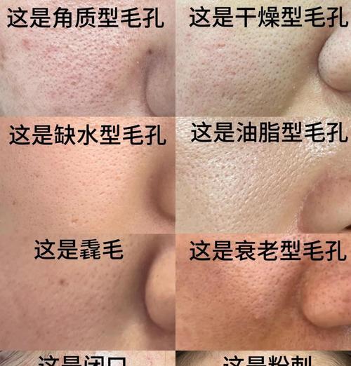 相机如何拍出清晰的毛孔照片？毛孔拍摄技巧有哪些？